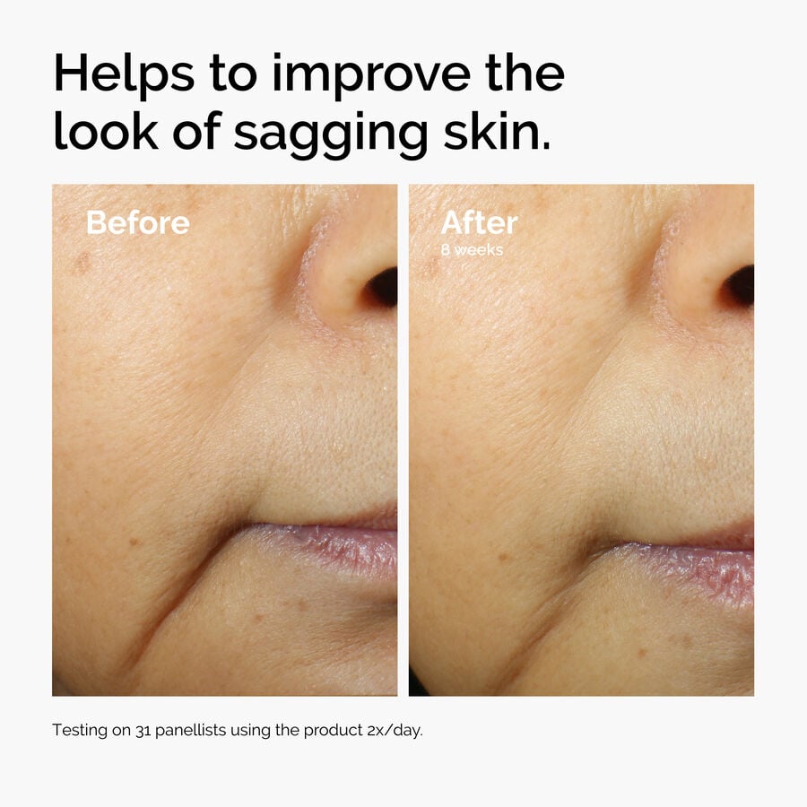 caffeine-3-escin-1-face-serum-e7 ord-caffeine-3pct-escin-1pct-face-serum-before-after-sagging.jpg