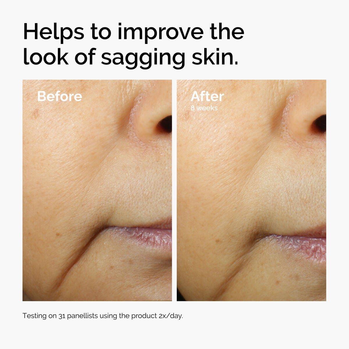 caffeine-3-escin-1-face-serum-e7 ord-caffeine-3pct-escin-1pct-face-serum-before-after-sagging.jpg