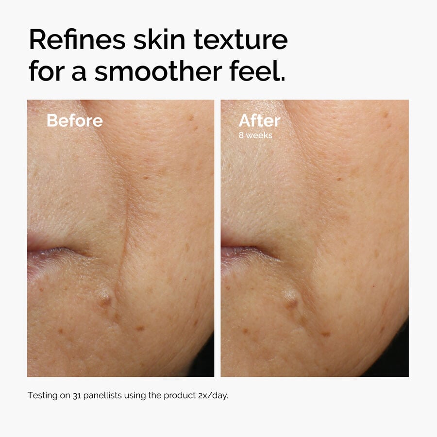 caffeine-3-escin-1-face-serum-e7 ord-caffeine-3pct-escin-1pct-face-serum-before-after-texture.jpg