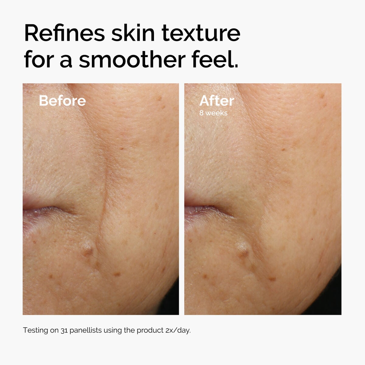 caffeine-3-escin-1-face-serum-e7 ord-caffeine-3pct-escin-1pct-face-serum-before-after-texture.jpg
