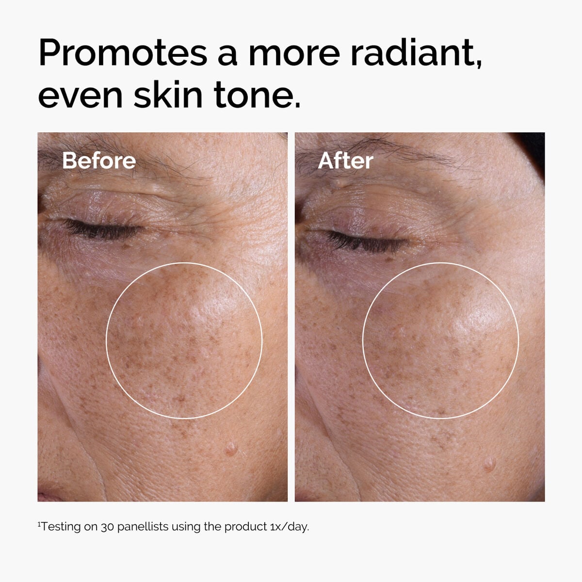 glycolic-acid-7-exfoliating-toner-o6 ord-glycolic-before-after-radiance.jpg