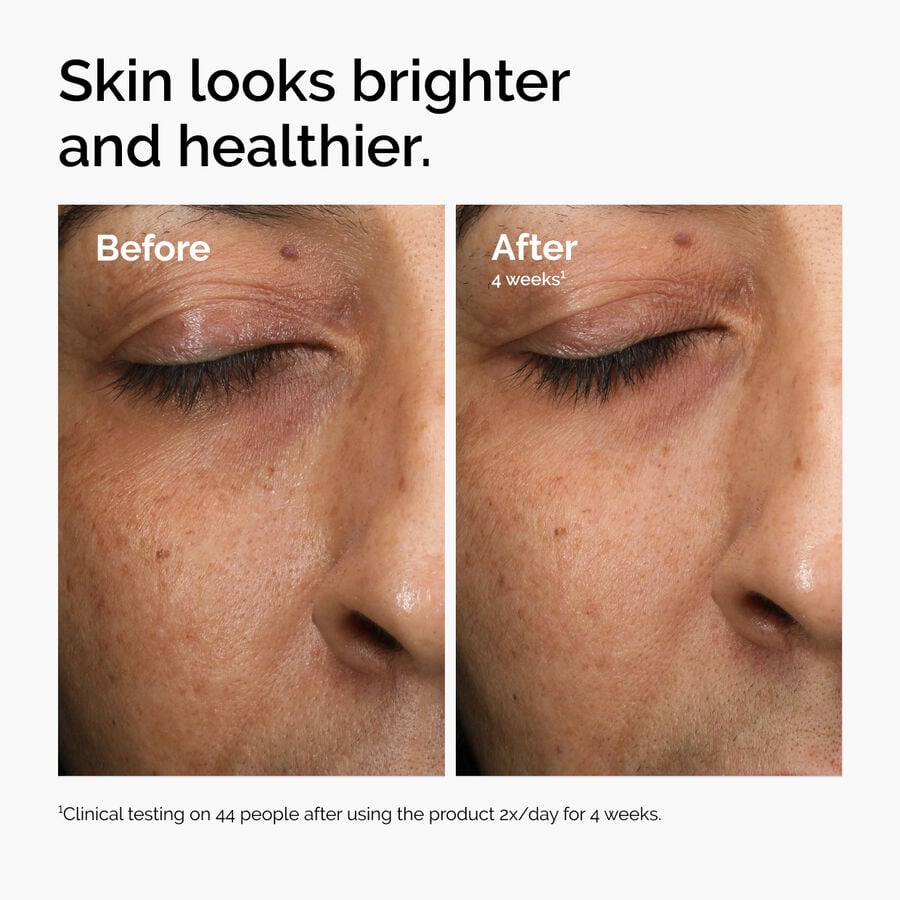 multi-antioxidant-radiance-serum-z2 ord-mars-before-after-healthy.jpg