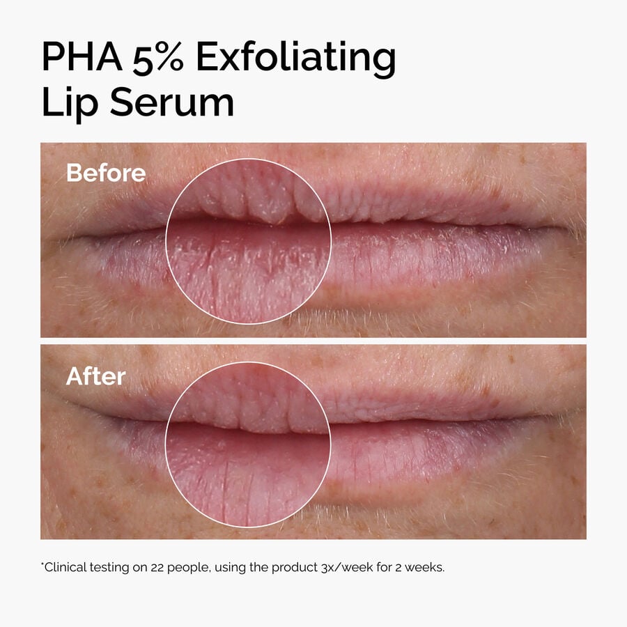pha-5-exfoliating-lip-serum-r2 ord-pha-5pct-lip-exfoliating-serum-before-after.jpg