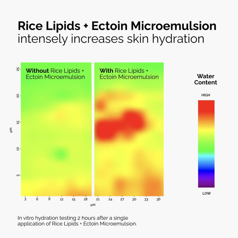 rice-lipids-ectoin-microemulsion-e3 ord-rice-lipids-ectoin-microemulsion-thermal-before-after.jpg