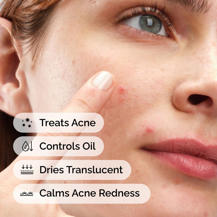 sulfur-10-powder-to-cream-concentrate-g8 ord-sulfur-10pct-powder-to-cream-concentrate-model-application-with-benefits-acne.jpg